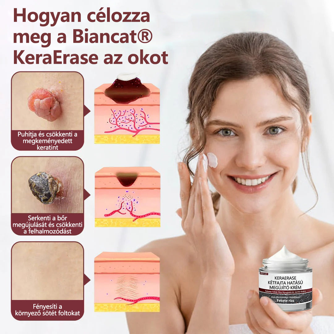 🔥🔥Biancat®KeraErase kettős hatású megújító krém