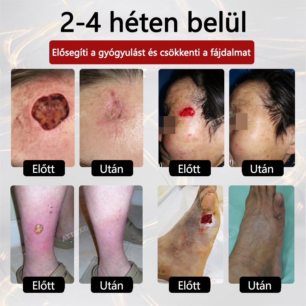 ⭐⭐⭐ATTDX® GlucoseGuard bőrmentő krém
