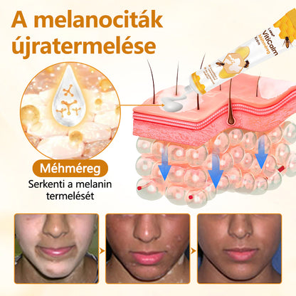 Laleia® VitiCalm méhméreg-krém🌻🌻🌻