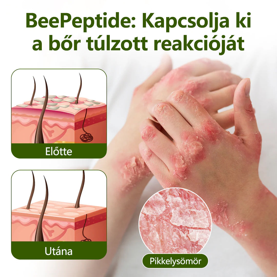 🔥🔥Timilk® MéhPeptid GyökérPuhító Kétirányú Megkönnyebbülés Krém