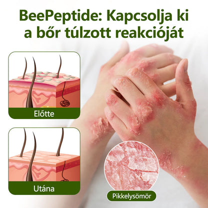 🔥🔥Timilk® MéhPeptid GyökérPuhító Kétirányú Megkönnyebbülés Krém