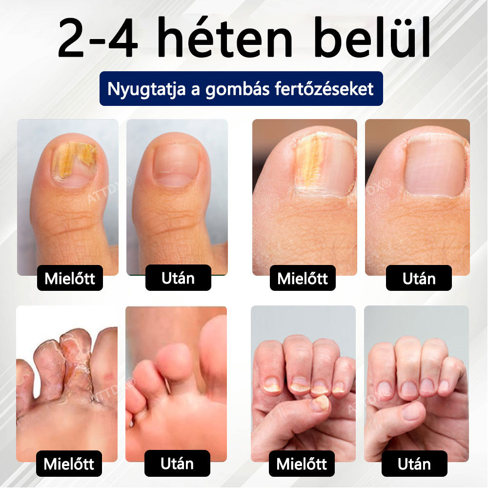 Croaie® Fungiclear Bee Therapy Nail Spray🎁