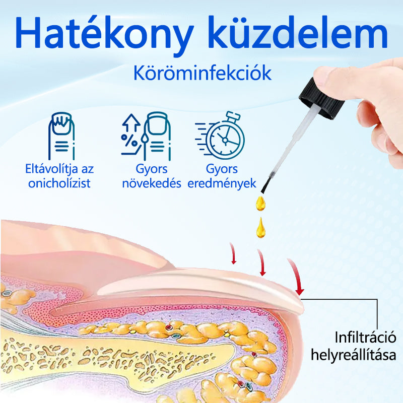 Biancat® OnyxoGuard Serum do wzrostu i naprawy paznokci🔥🔥