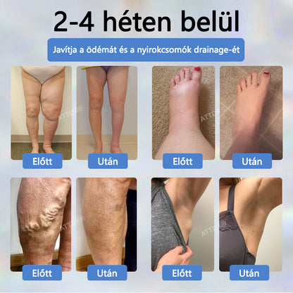 Cvreoz® Fekete kömény Ödéma méregtelenítő gyógynövénykrém🌿🌿