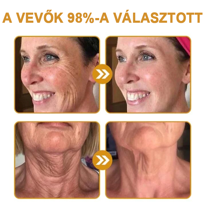 🍀Az akció utolsó napja: 83% kedvezmény✨𝐅𝐮𝐫𝐳𝐞𝐫𝐨™ Ránctalanító Krém Méhméreggel és Botox Hatással🐝