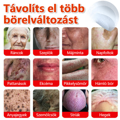 ✅KUBOZN® Mikrotűs Botanikus Bőrkinövés Eltávolító Tapaszok | Magyarországon készült