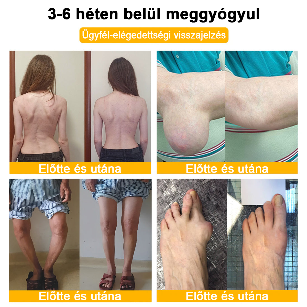 𝐀𝐫𝐭𝐡𝐫𝐨𝐅𝐫𝐞𝐞™Méhméreg fájdalomcsillapító csontgyógyító krém(Különösen az idősebb felnőtteknek és a DGOU által ajánlott) ✨Különleges ajánlat korlátozott ideig✨