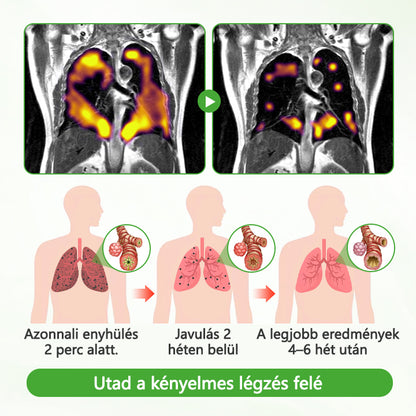 ATTDX® Mulleaf gyógynövényes tüdőtisztító🌿