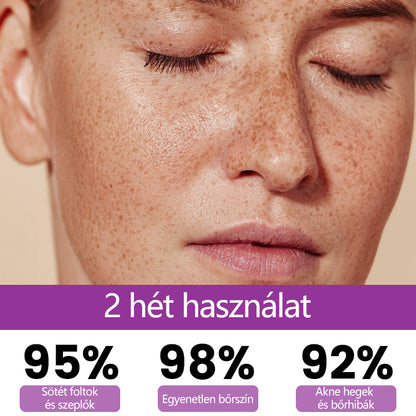 ✨✨✨Ceoerty® MelantraX Advanced Anti-Hyperpigmentáció elleni esszencia