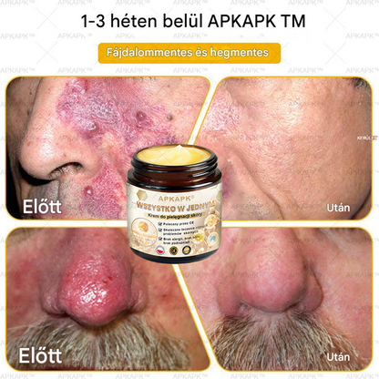 𝑨𝑷𝑲𝑨𝑷𝑲™ Hatékony krém a teljes bőrápoláshoz🔥