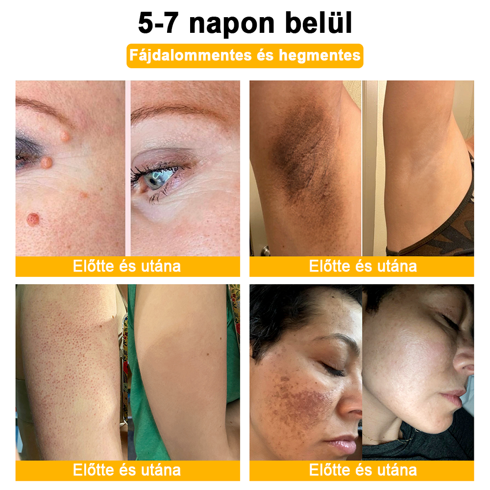 🏵️[Hivatalos zászlóshajó üzlet] 𝑻𝒖𝒓𝒐𝒏𝒖™ méhméreg bőrápoló krém (👨‍⚕𝐀𝐀𝐃 JAVASLATOK)