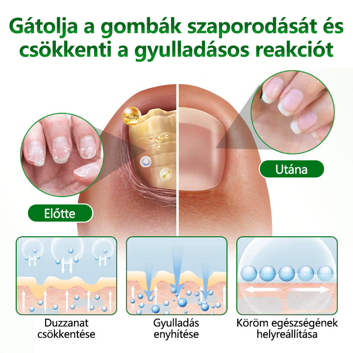 Timilk® HerbaNail 7 napos regeneráló szérum 🔥🔥 FDA tanúsítvánnyal rendelkezik