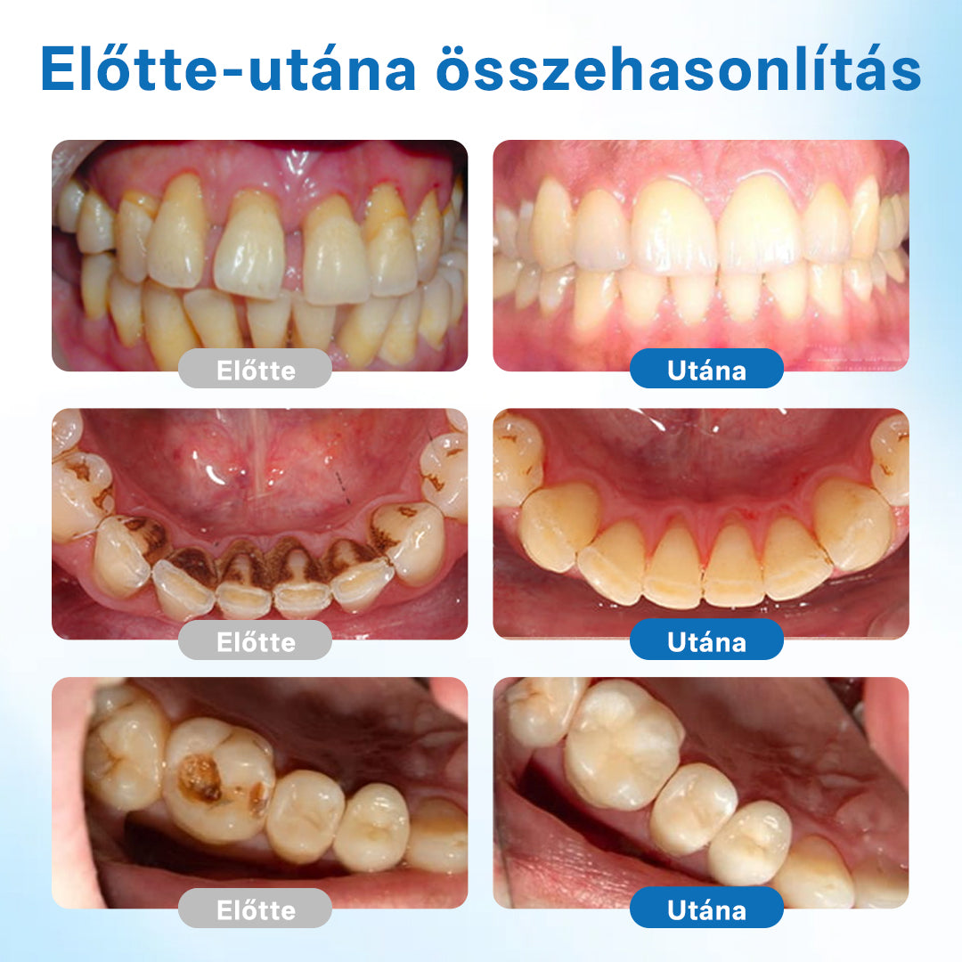 🔥🔥Biancat® NanoHAP Tooth Defense Serum