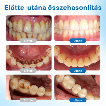 🔥🔥Biancat® NanoHAP Tooth Defense Serum