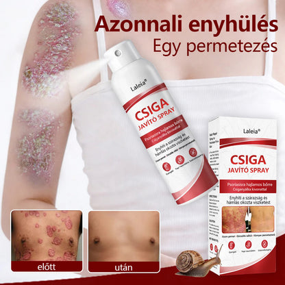 🔥Laleia® csigahéjas spray viszkető, hámló pikkelysömörös bőrre
