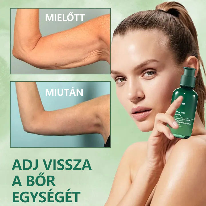 🌿💝A 60%-os akció utolsó napja - Fubsta™ öregedésgátló bőrfeszesítő szérum🔥🔥