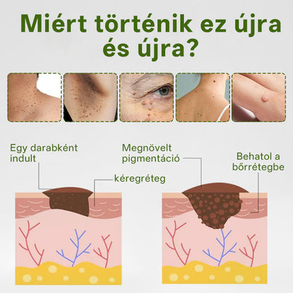 🔥🔥Timilk® ThujaClear növényi szemölcs krém