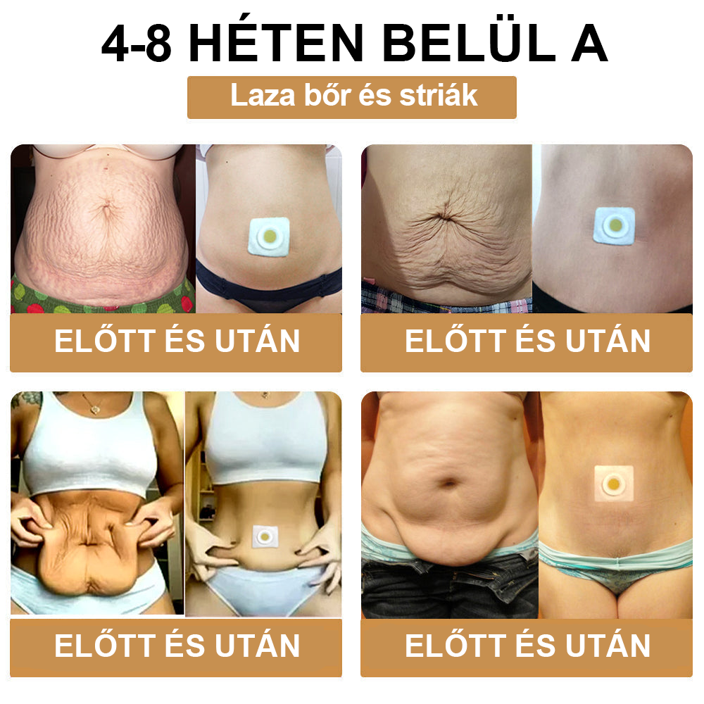 👑ZVLZVL™ Méhméreg Lymphatic DetoxFogyasztó Tapasz 🔥𝐊𝐨𝐫𝐥á𝐭𝐨𝐳𝐨𝐭𝐭 𝐢𝐝𝐞𝐢𝐠 𝟕𝟎% 𝐊𝐄𝐃𝐕𝐄𝐙𝐌É𝐍𝐘🔥 (Szabadalmazott módszerrel az összes korosztály számára)