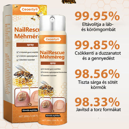 ✅[Korlátozott idejű ajánlat, érkezési sorrendben]✅Ceoerty® NailRescue méhméreg spray