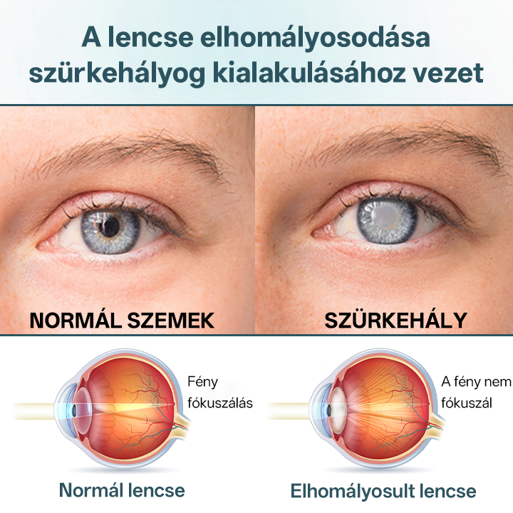 ✅Timilk® OptiFusion Nano szemcsepp szérum🎉