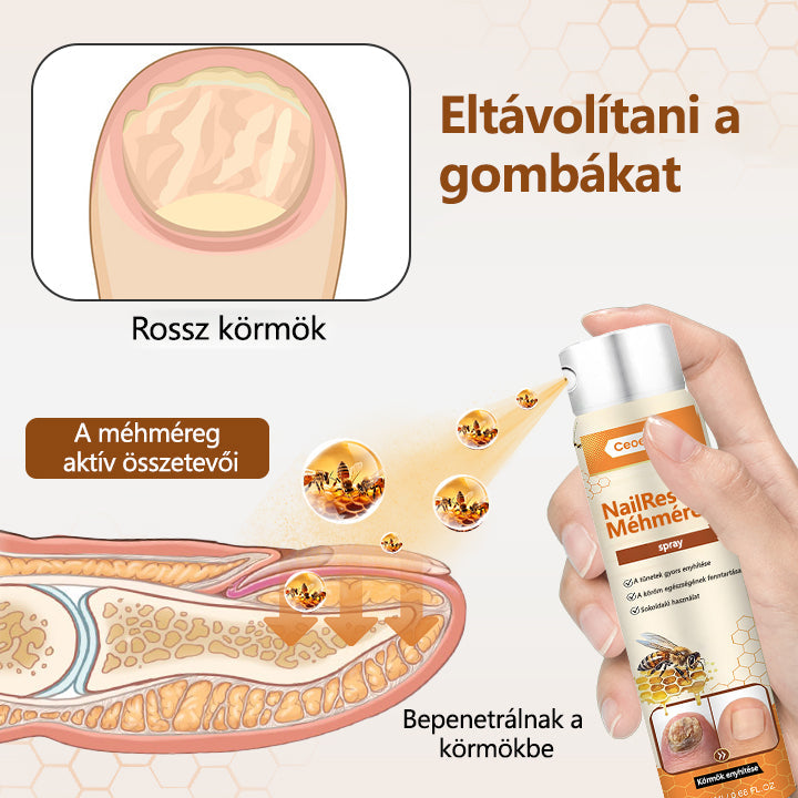 ✅[Korlátozott idejű ajánlat, érkezési sorrendben]✅Ceoerty® NailRescue méhméreg spray