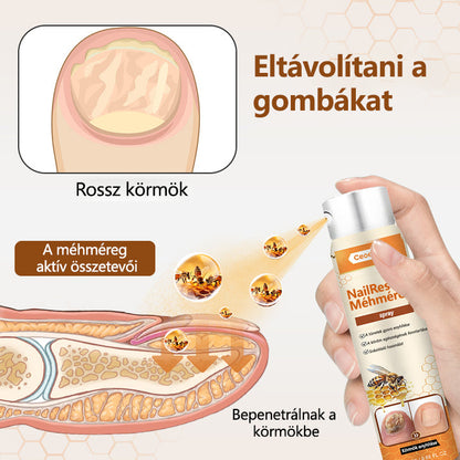 ✅[Korlátozott idejű ajánlat, érkezési sorrendben]✅Ceoerty® NailRescue méhméreg spray