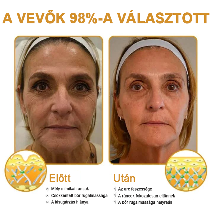🍀Az akció utolsó napja: 83% kedvezmény✨𝐅𝐮𝐫𝐳𝐞𝐫𝐨™ Ránctalanító Krém Méhméreggel és Botox Hatással🐝