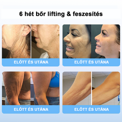 75% kedvezmény 🎉 Fubsta® Fejlett feszesítő és ránctalanító krém: Visszaállítja a bőr rugalmasságát 💧 Élénkítse fel bőrét, és ragyogjon 2025-ben! 🌟✨