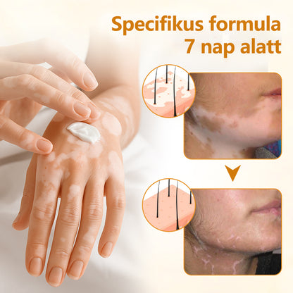 Timilk® VitiCalm méhméreg-krém🌻🌻