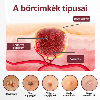 🔥🔥Biancat®KeraErase kettős hatású megújító krém