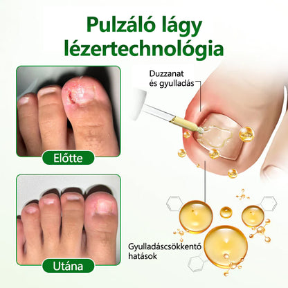 Timilk® HerbaNail 7 napos regeneráló szérum 🔥🔥 FDA tanúsítvánnyal rendelkezik