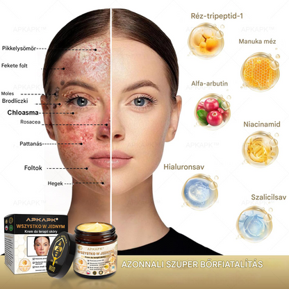 𝑨𝑷𝑲𝑨𝑷𝑲™ Hatékony krém a teljes bőrápoláshoz🔥