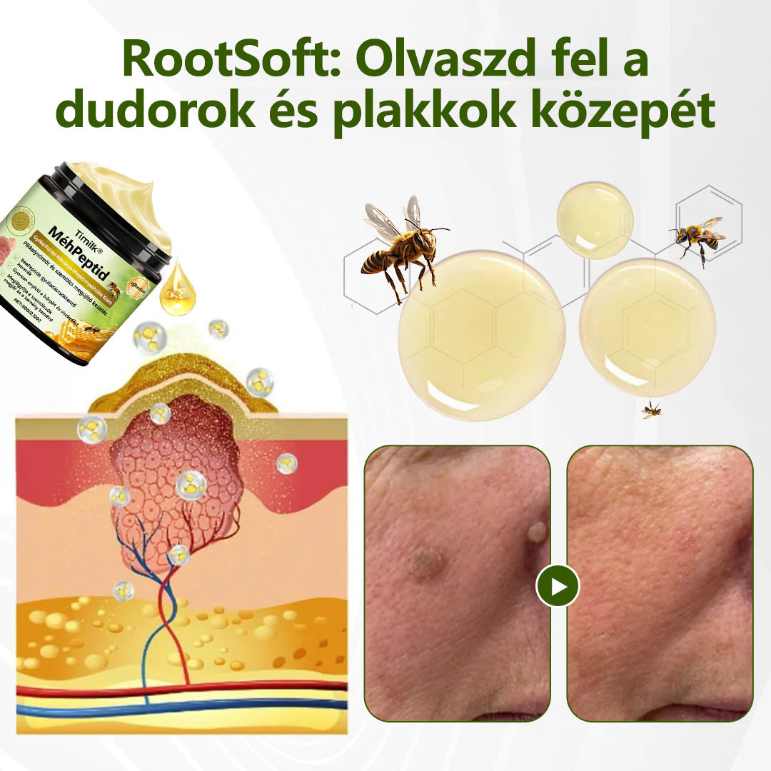 🔥🔥Timilk® MéhPeptid GyökérPuhító Kétirányú Megkönnyebbülés Krém