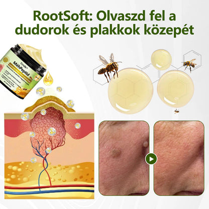 🔥🔥Timilk® MéhPeptid GyökérPuhító Kétirányú Megkönnyebbülés Krém