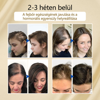 Timilk® VitaStrand Biotin hajnövekedést elősegítő spray✅ Sűrű, fényes haj néhány hét alatt