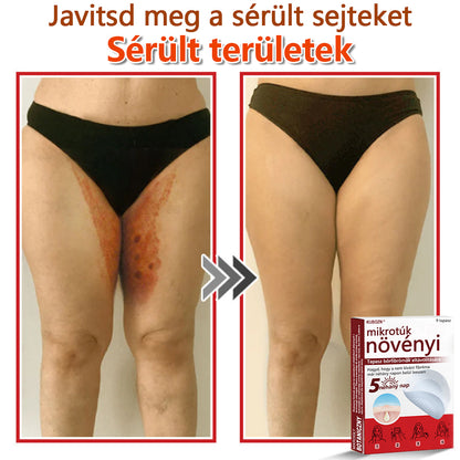 ✅KUBOZN® Mikrotűs Botanikus Bőrkinövés Eltávolító Tapaszok | Magyarországon készült