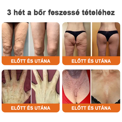 💝Készült és szállított az Egyesült Királyságból✨EdiJonah™ Botox Bee Venom Firming Serum Stick🔥LAST DAY 70% OFF✨✨✨