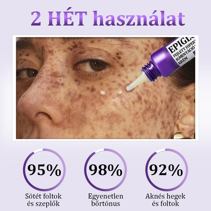 🔥🔥𝐎𝐆𝐘É𝐈 által jóváhagyva | 𝐅𝐮𝐫𝐳𝐞𝐫𝐨® 𝐄𝐏𝐈𝐆𝐋𝐎𝐖 𝐌𝐞𝐥𝐚𝐧𝐄𝐗 Fejlett Hiperpigmentáció Elleni Krém