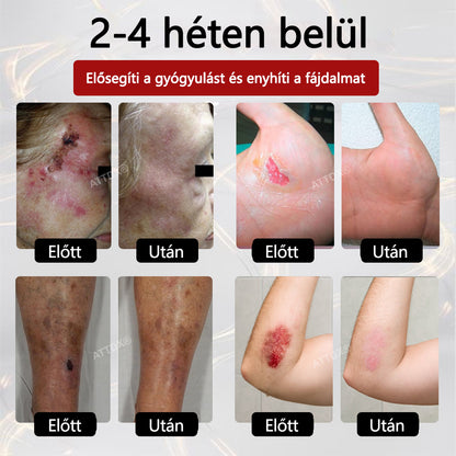 ⭐⭐⭐ATTDX® GlucoseGuard bőrmentő krém