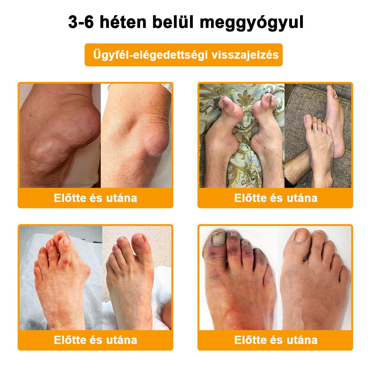 𝐀𝐫𝐭𝐡𝐫𝐨𝐅𝐫𝐞𝐞™Méhméreg fájdalomcsillapító csontgyógyító krém(Különösen az idősebb felnőtteknek és a DGOU által ajánlott) ✨Különleges ajánlat korlátozott ideig✨