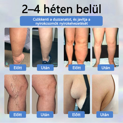 💧💧💧ATTDX® Növényi ödéma enyhítő krém nigellával