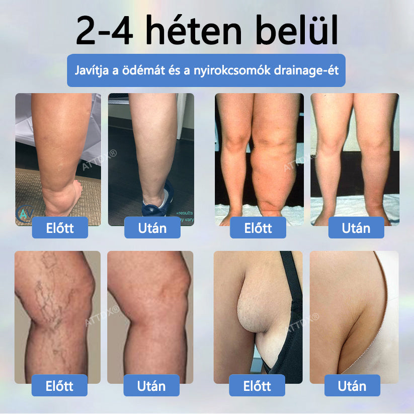 Cvreoz® Fekete kömény Ödéma méregtelenítő gyógynövénykrém🌿🌿