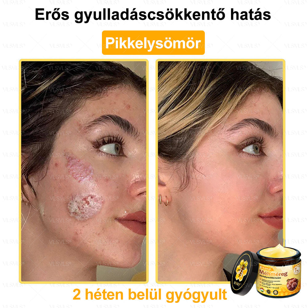 💪VLSVLS® Méhméreg Bőrhelyreállító Krém (👨‍⚕‍CE jóváhagyott)👍✅✅