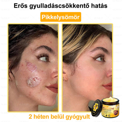💪VLSVLS® Méhméreg Bőrhelyreállító Krém (👨‍⚕‍CE jóváhagyott)👍✅✅