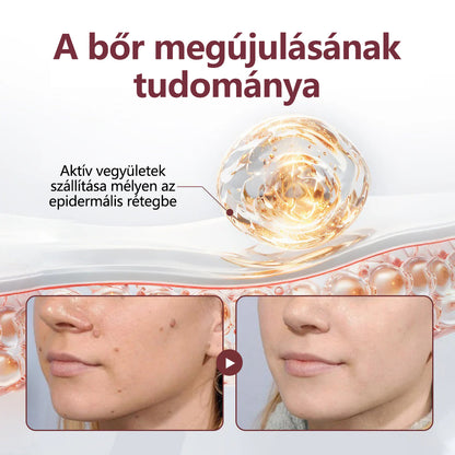 ⭐Laleia®KeraErase kettős hatású megújító krém