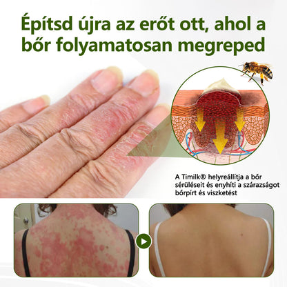 🔥🔥Timilk® MéhPeptid GyökérPuhító Kétirányú Megkönnyebbülés Krém