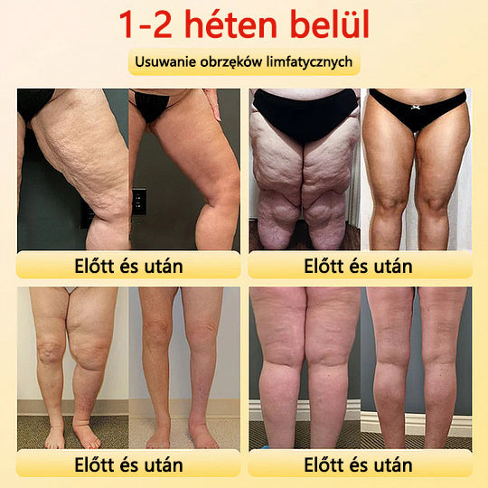 🎉 Korlátozott idejű ajánlat - hatalmas kedvezmény! 🔥 Akár 90% KEDVEZMÉNY! Sfrcord™ titánszálas önmelegedő turmalin formáló rövidnadrág✅