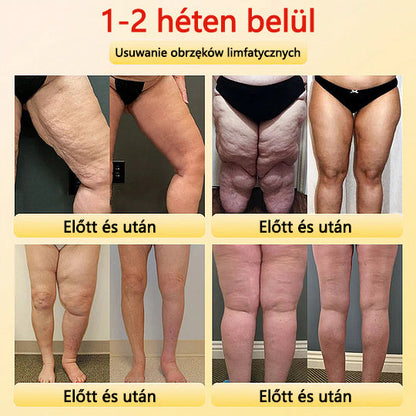 🎉 Korlátozott idejű ajánlat - hatalmas kedvezmény! 🔥 Akár 90% KEDVEZMÉNY! Sfrcord™ titánszálas önmelegedő turmalin formáló rövidnadrág✅