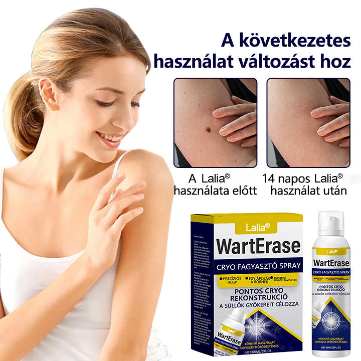 Laleia®✅ WartErase – Fagyasztó Szemölcseltávolító Spray