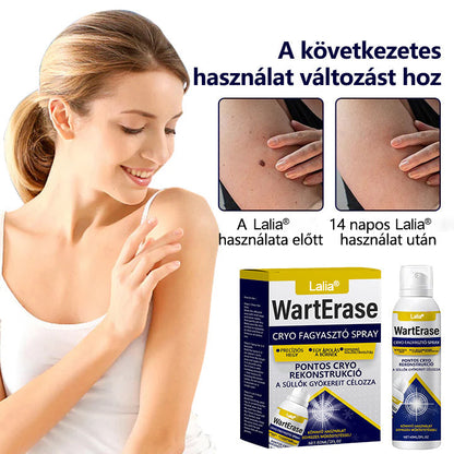 Laleia®✅ WartErase – Fagyasztó Szemölcseltávolító Spray